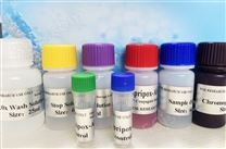 人白细胞介素2ELISA试剂盒价格